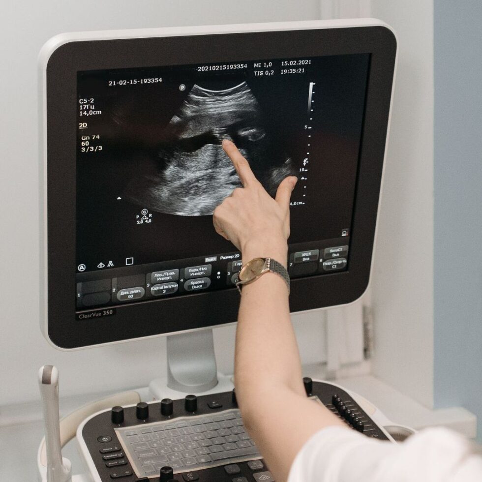 Pet Ultrasound In Missoula MT Animal Blessings Pet Hospital